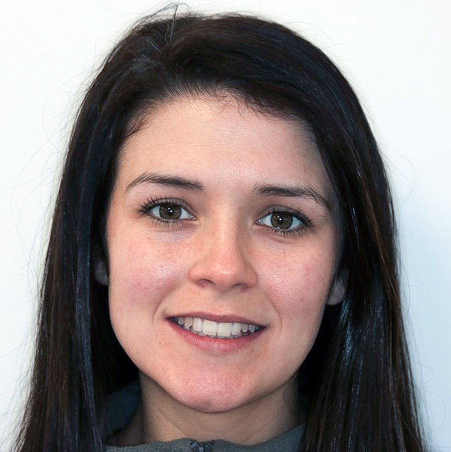 Invisalign After - Evelyn 